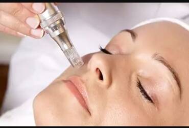 Wat is dermapen micro-needling?