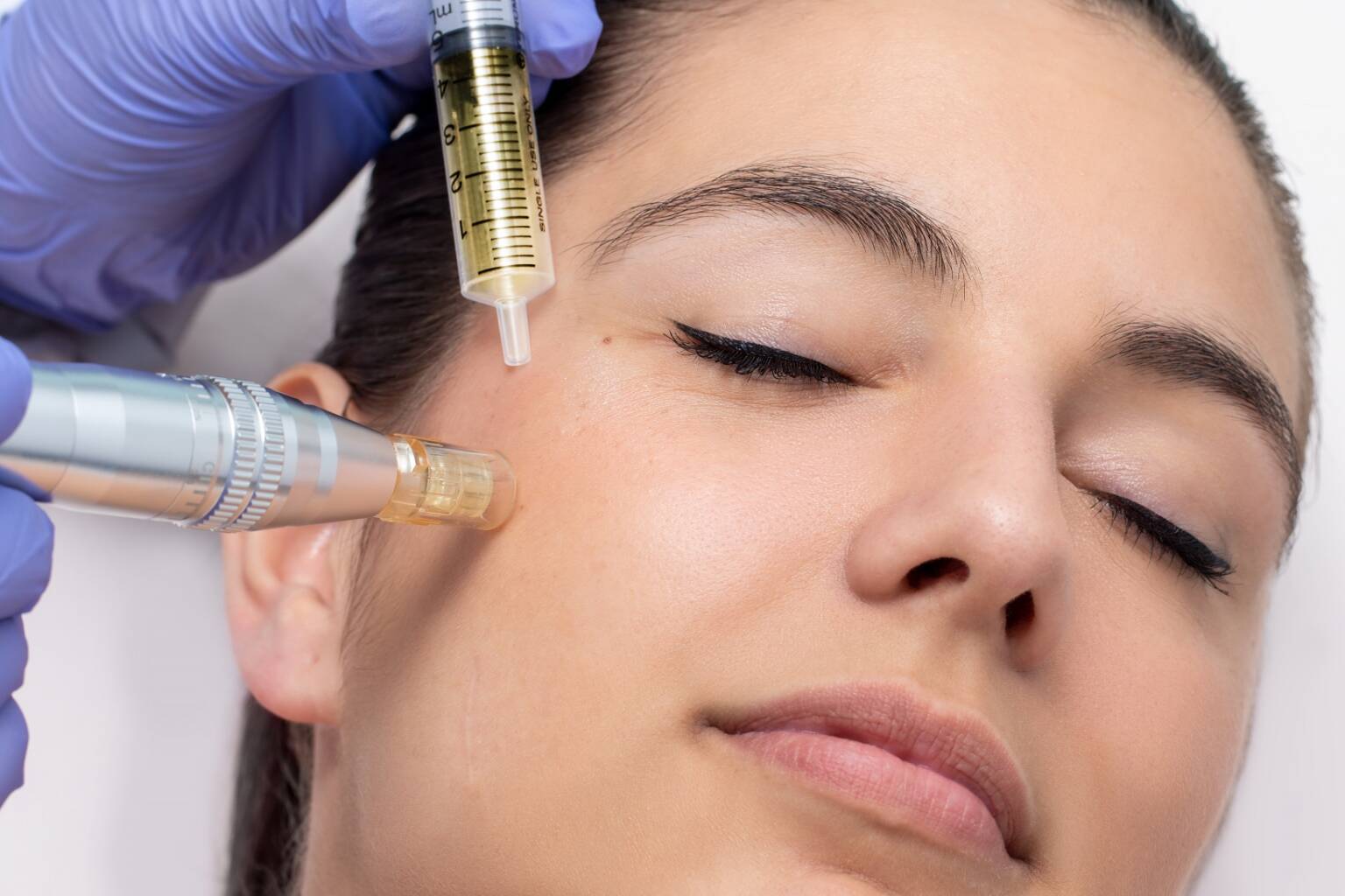 Wat Is Dermapen Micro-needling? – Sayna Skin & Beauty